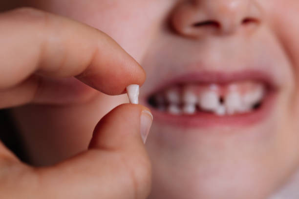 10 Biblical Meaning Of Dreams About Teeth Falling Out